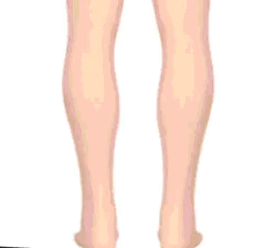 Orthopädische Sandalen mit Fußgewölbe-Unterstützung für Damen